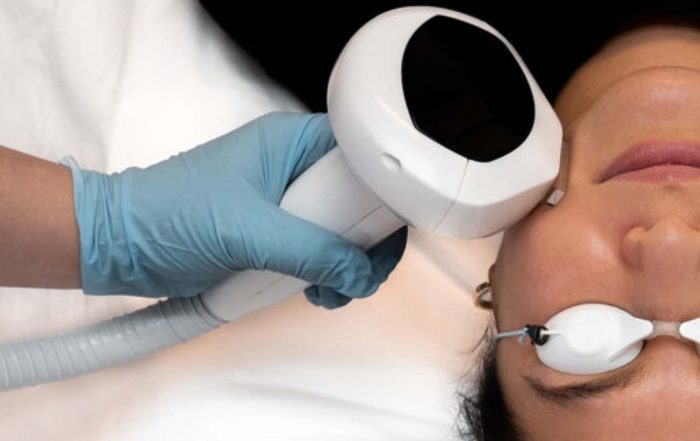What Are the Benefits of Intense Pulsed Light Therapy - Niagara Medical Esthetics