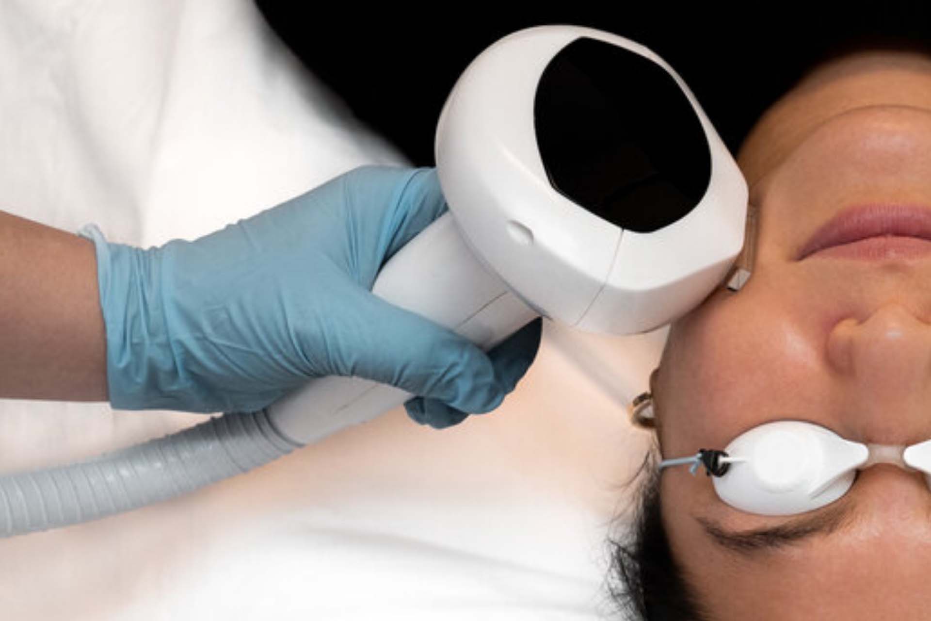 What Are the Benefits of Intense Pulsed Light Therapy - Niagara Medical Esthetics