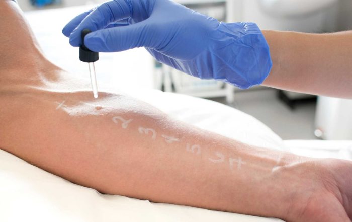 The Importance of Patch Testing in Laser Hair Removal - Niagara Medical Esthetics