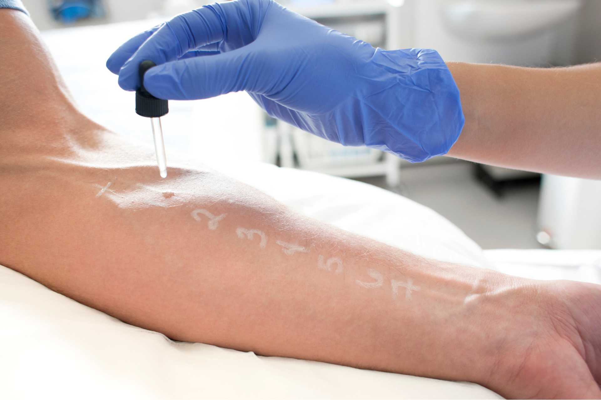 The Importance of Patch Testing in Laser Hair Removal - Niagara Medical Esthetics