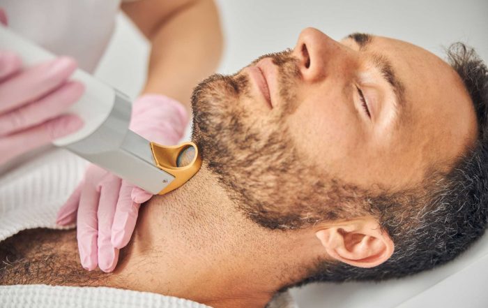 Laser Hair Removal: Is It Right for Your Skin Type? - Niagara Medical Esthetics
